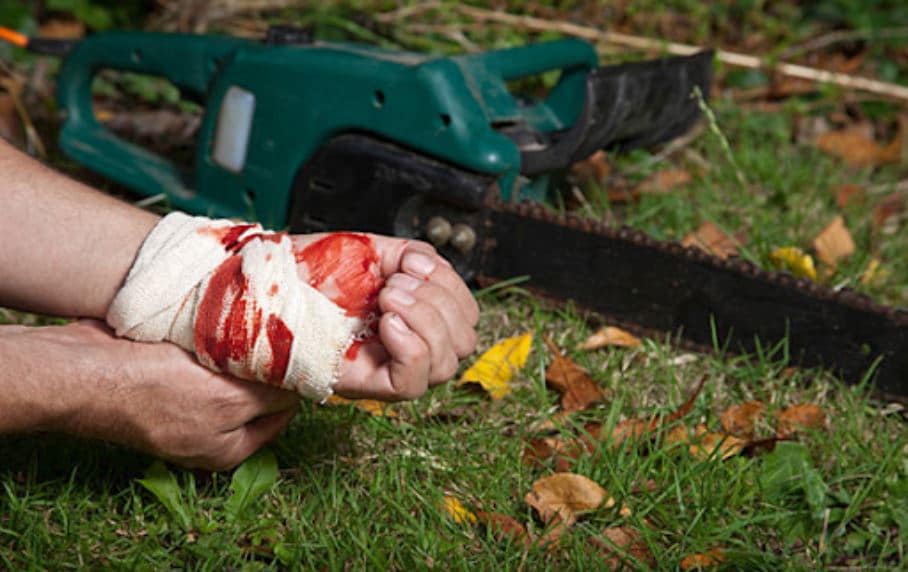 chainsaw kickback injuries