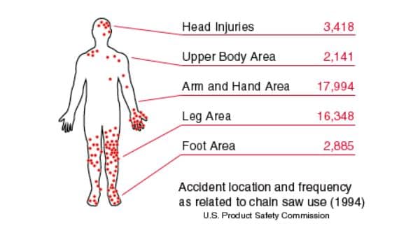 chainsaw injury statistics